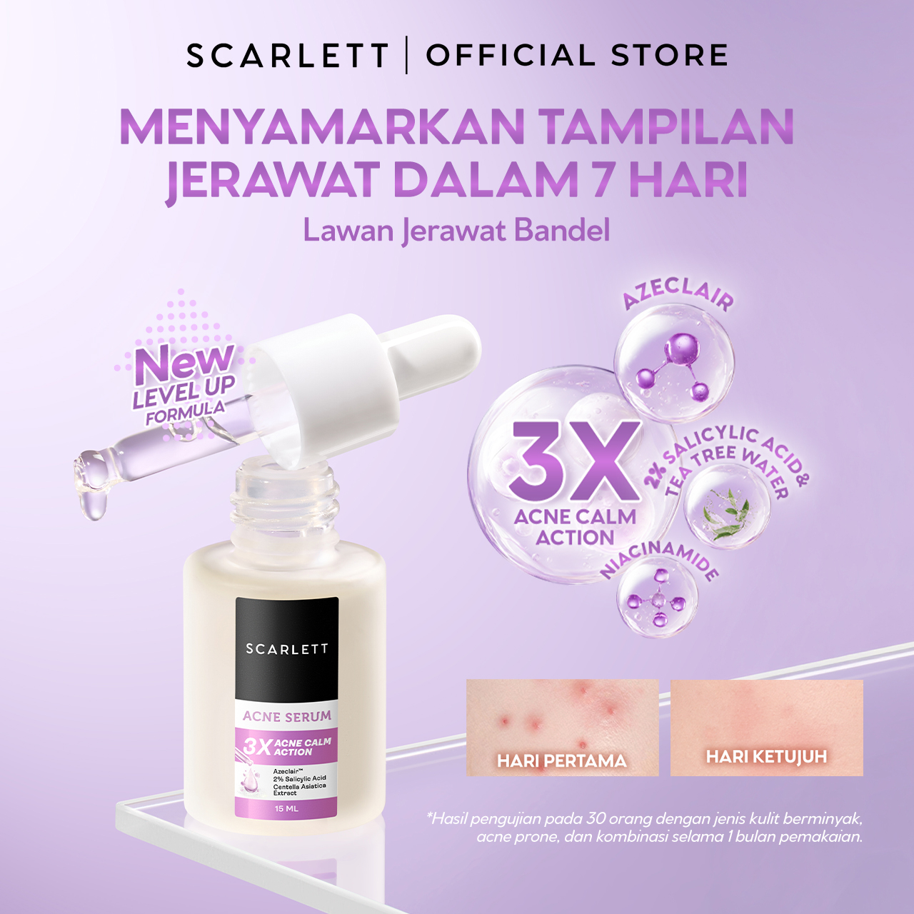 Scarlett 5in1 Acne Set