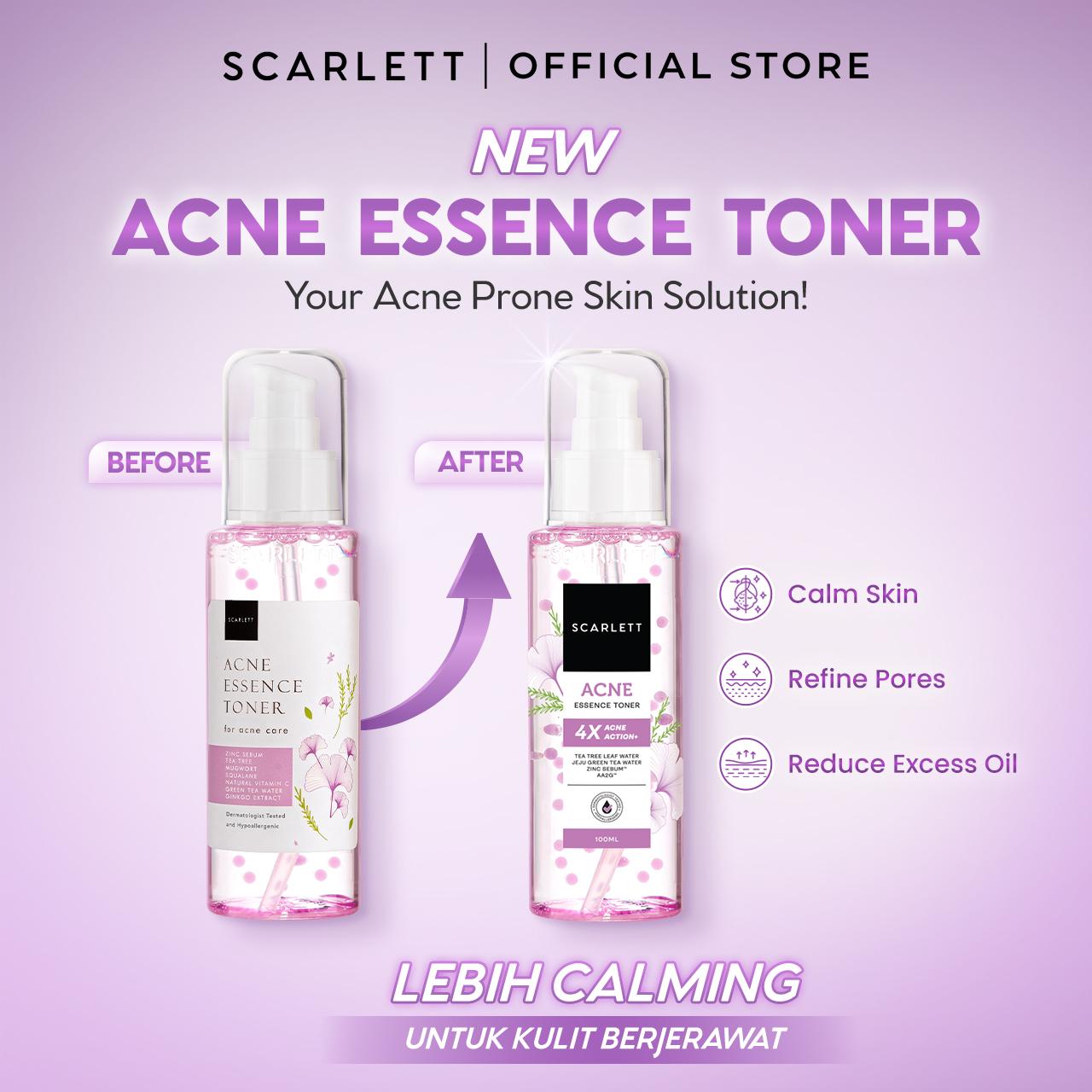 Scarlett Acne Essence Toner