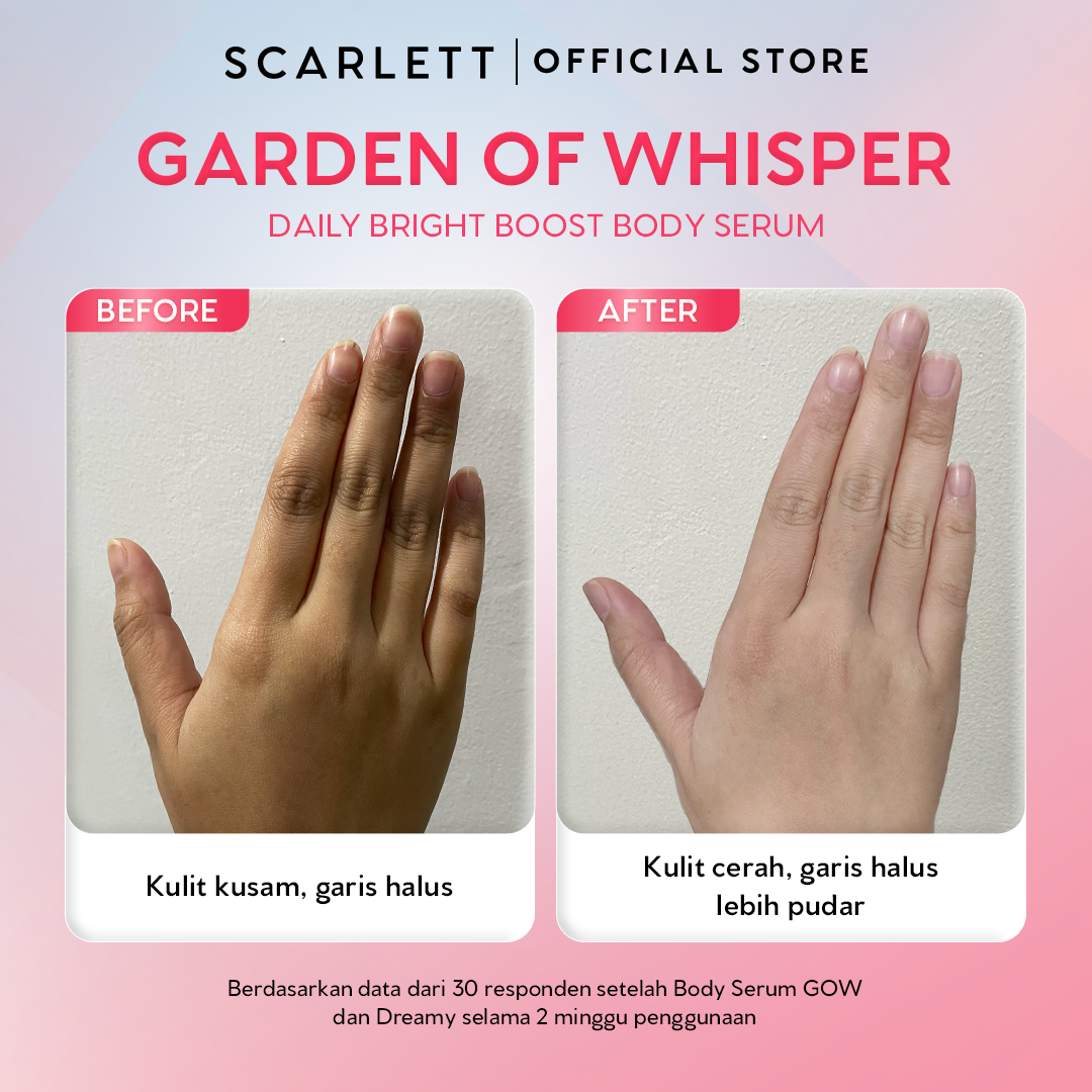 [NEW LAUNCH] SCARLETT GLUCINAMIDE Fragrance Brightening Body Serum Garden of Whisper 170ml