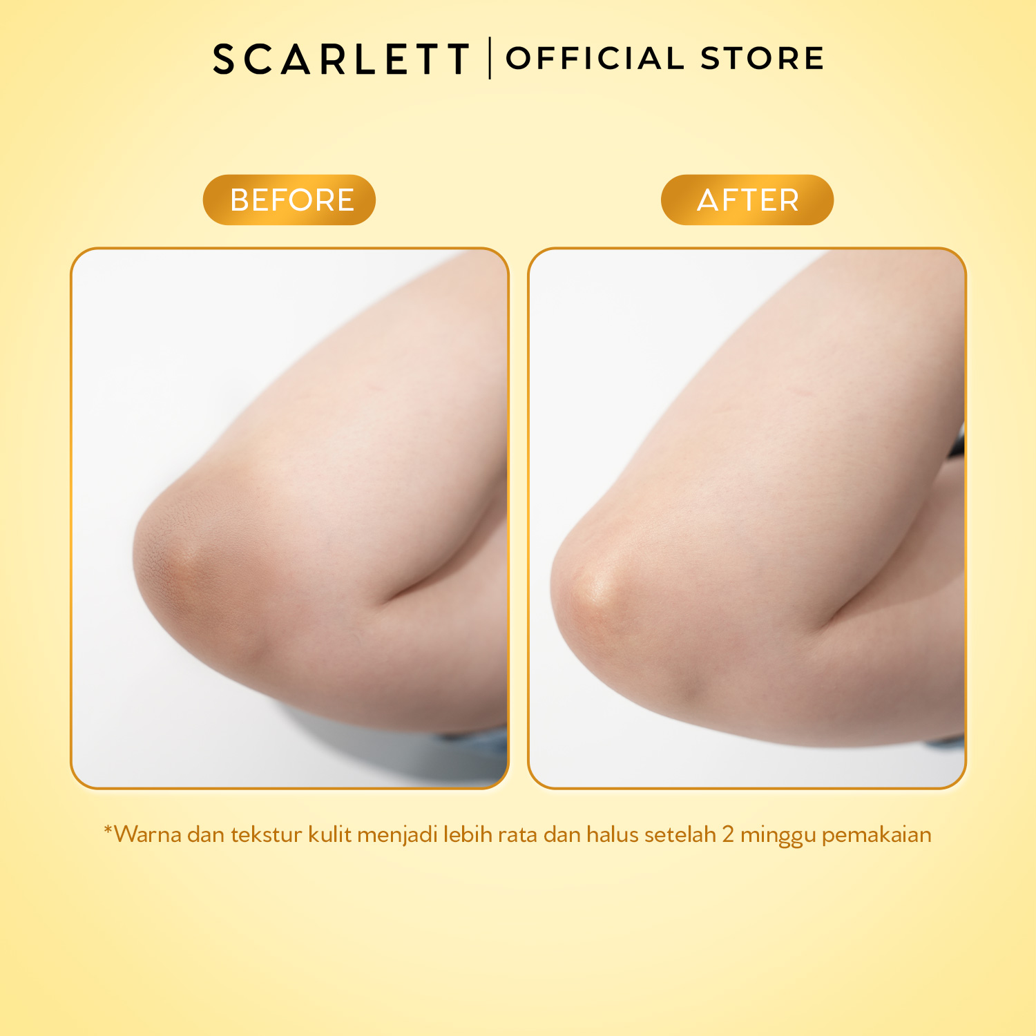 [NEW LAUNCH] SCARLETT Intense Brightening AHA Body Booster 10% AHA BHA PHA PRO-WHITE