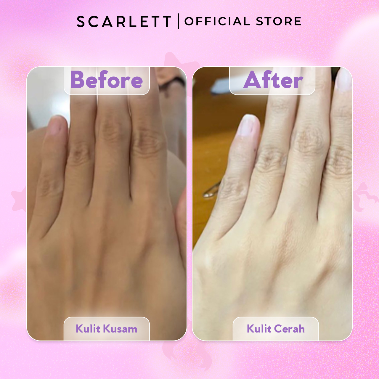 SCARLETT 10% NIACINAMIDE Fragrance Brightening Bundling Body Serum Tube Velvet Rouge & Purple Kiss 170ml