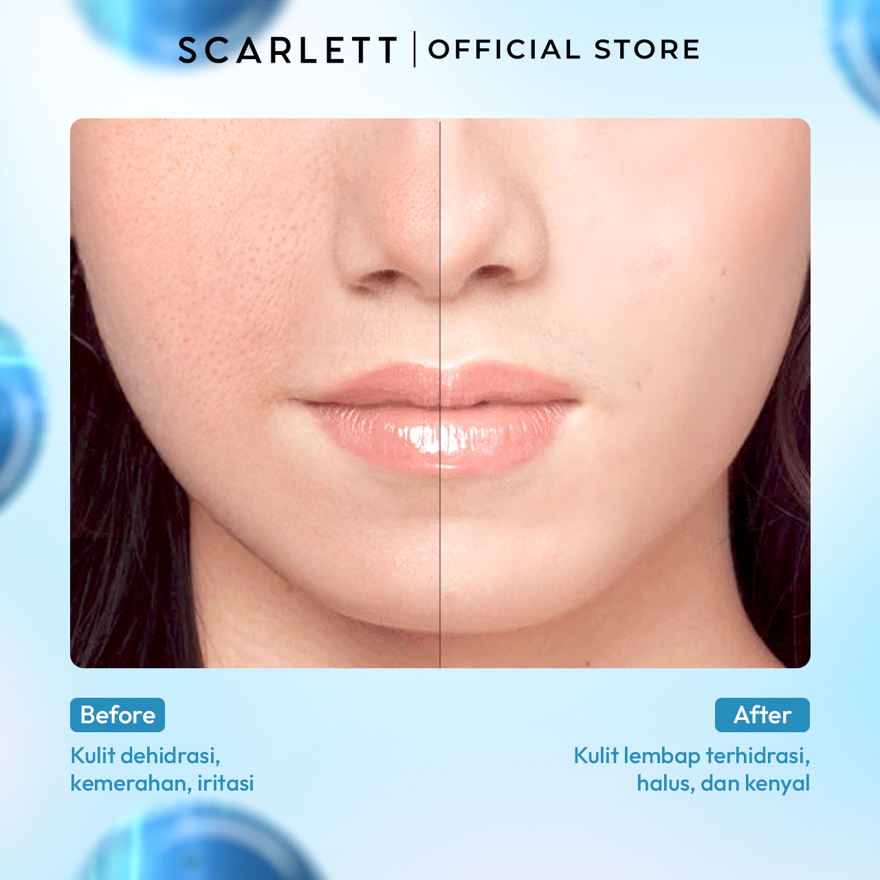 Scarlett Blue Hydra Intensive Calming Solution