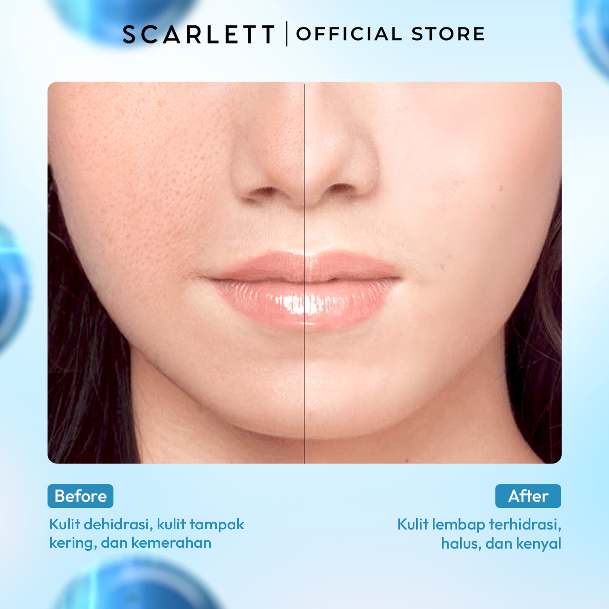 Scarlett Blue Hydra Intensive Calming Solution