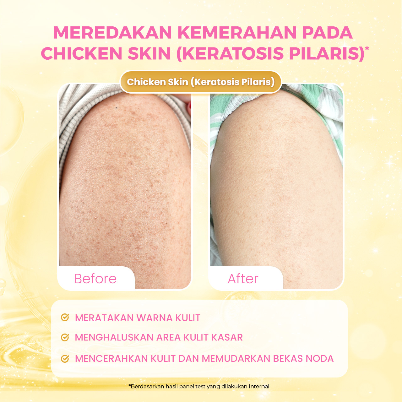 Scarlett Intense Brightening AHA Body Serum 5% AHA BHA PHA