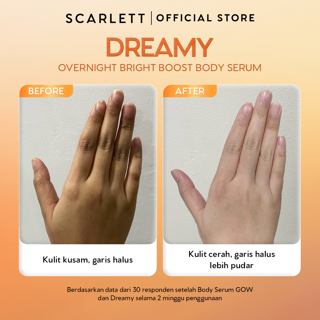 [NEW LAUNCH] SCARLETT GLUCINAMIDE Fragrance Brightening Body Serum Dreamy 170ml