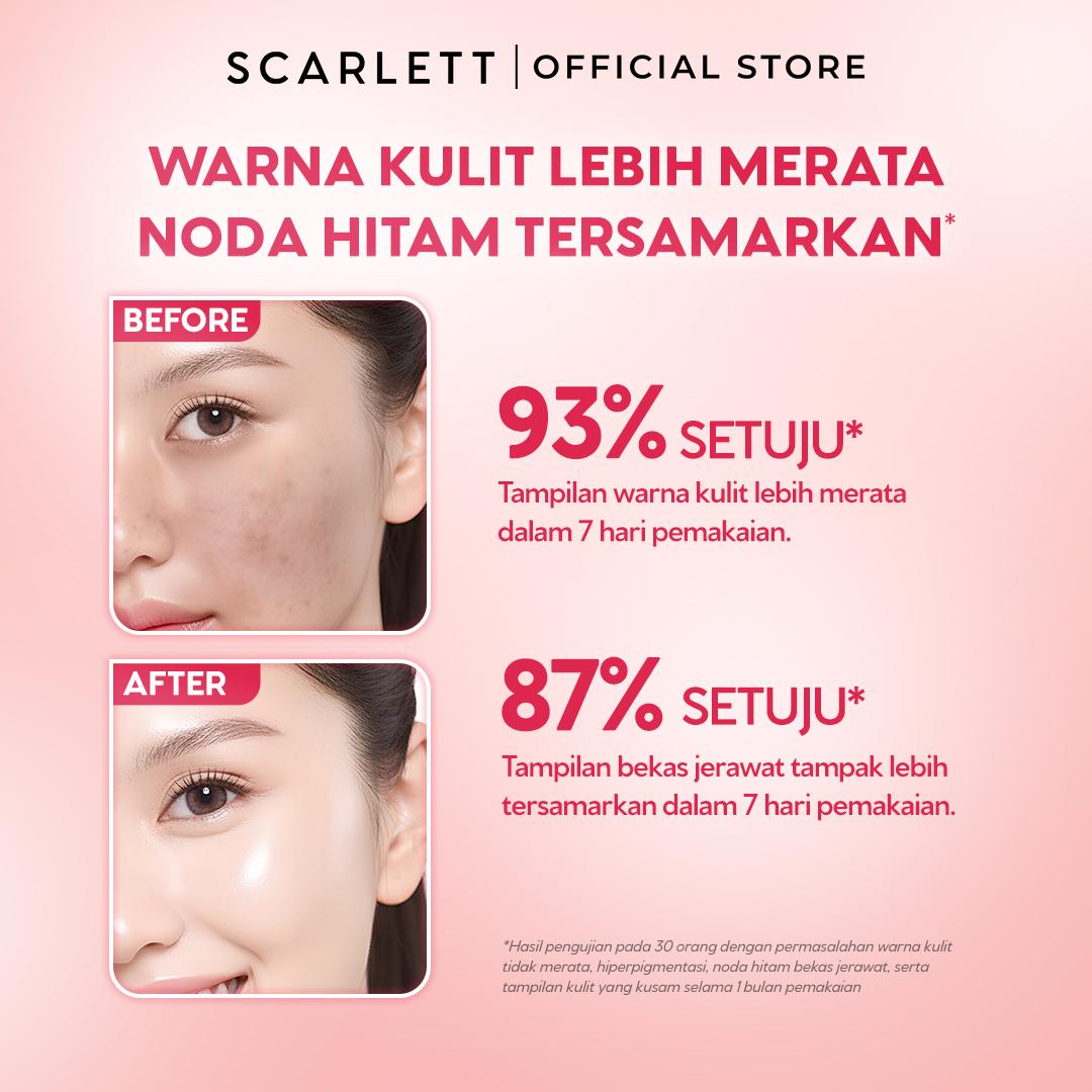 NEW FORMULA Scarlett Brightly Advance Serum 10% Niacinamide Alpha Arbutin Synovea - Serum brightening, Serum pencerah, Membantu Menyamarkan dark spot, Memperbaiki warna kulit tidak merata, menyamarkan bekas jerawat