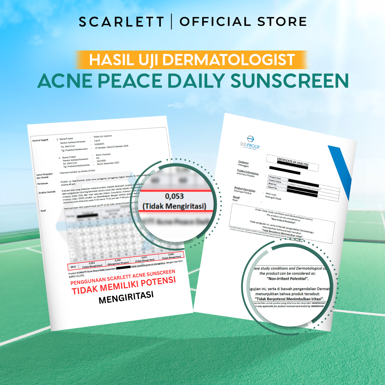 SCARLETT Acne Peace Daily Sunscreen