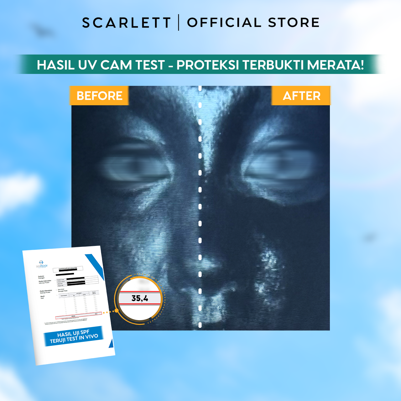 SCARLETT Twinpack Acne Peace Daily Sunscreen