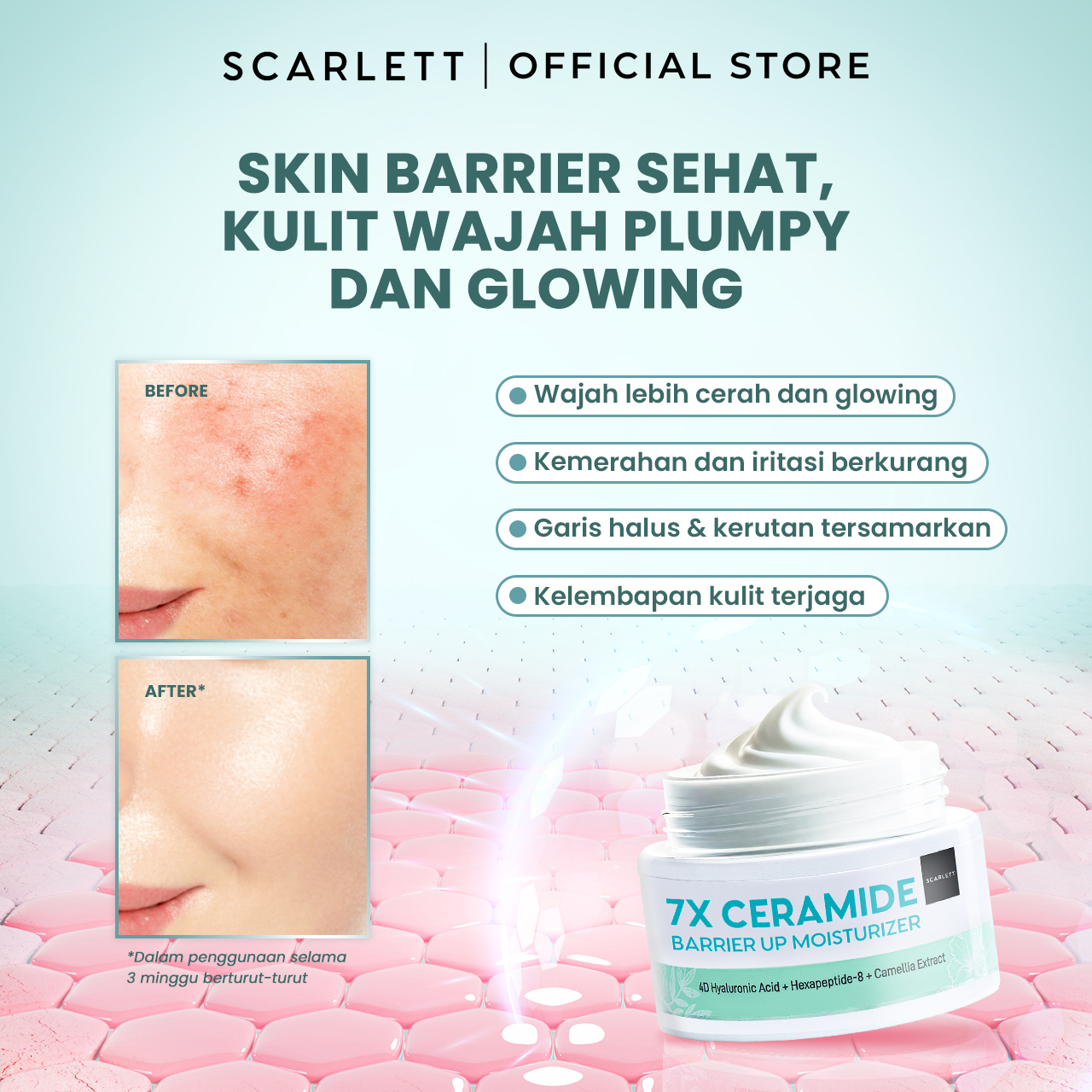 Scarlett 7X Ceramide Moisturizer 20Gr - Pelembab Wajah untuk Memperbaiki Skin Barrier Mencerahkan Melembabkan Calming | Kulit Glowing Plumpy | Untuk Kulit Sensitif Jerawat Kering