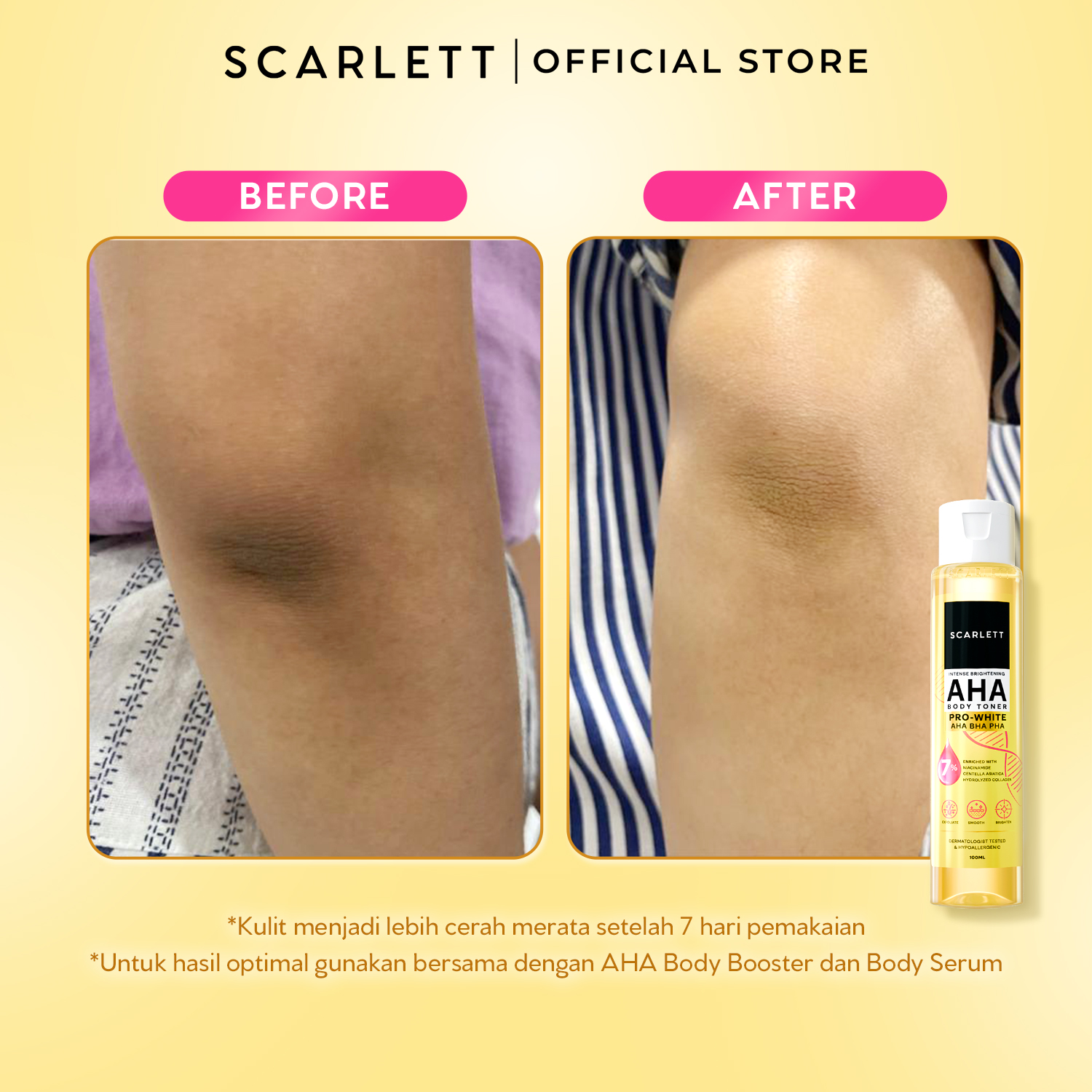 [NEW] Scarlett Intense Brightening AHA Body Toner