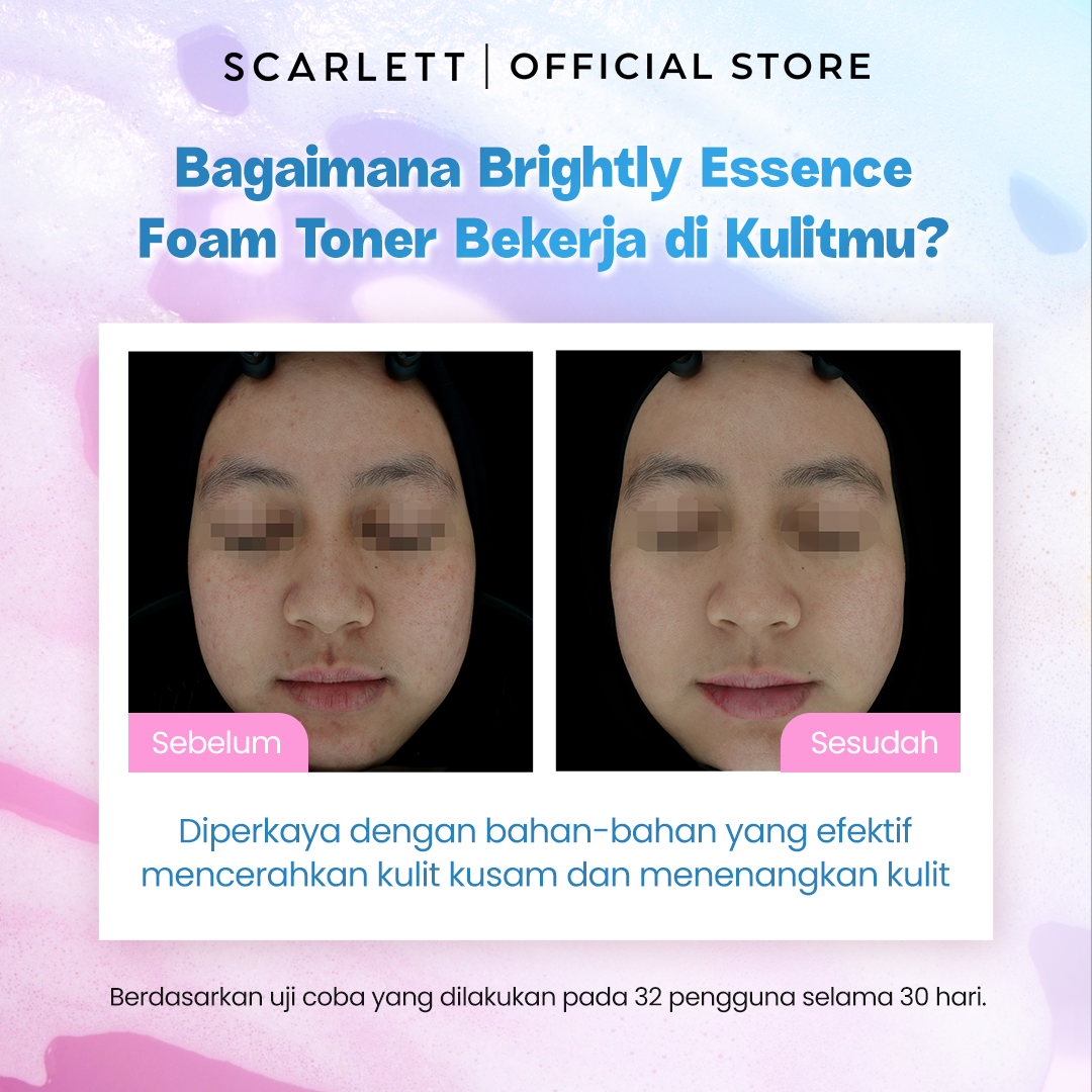 Scarlett Brightly Ever After Essence Foam Toner - 105ml