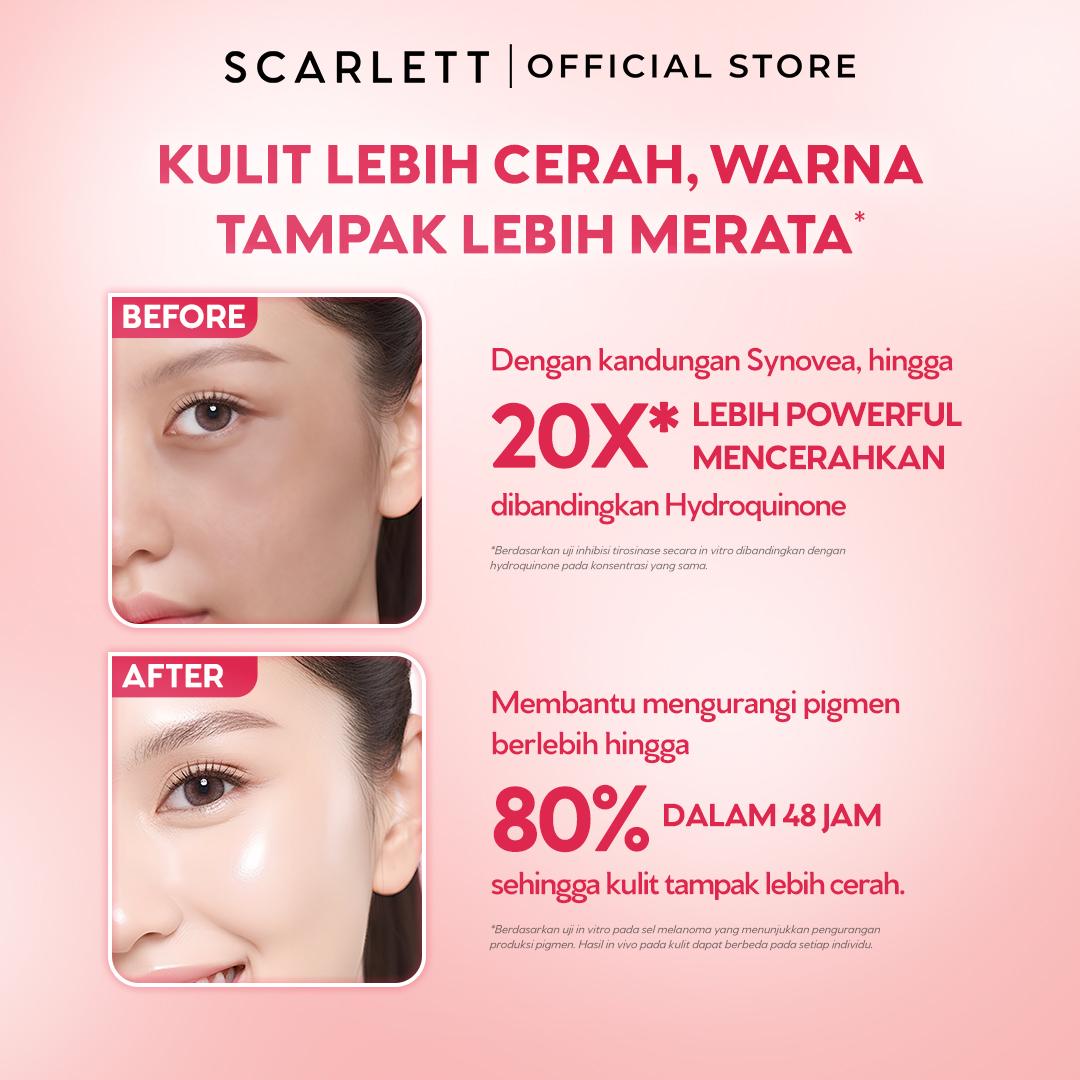 NEW FORMULA Scarlett Brightly Advance Serum 10% Niacinamide Alpha Arbutin Synovea - Serum brightening, Serum pencerah, Membantu Menyamarkan dark spot, Memperbaiki warna kulit tidak merata, menyamarkan bekas jerawat