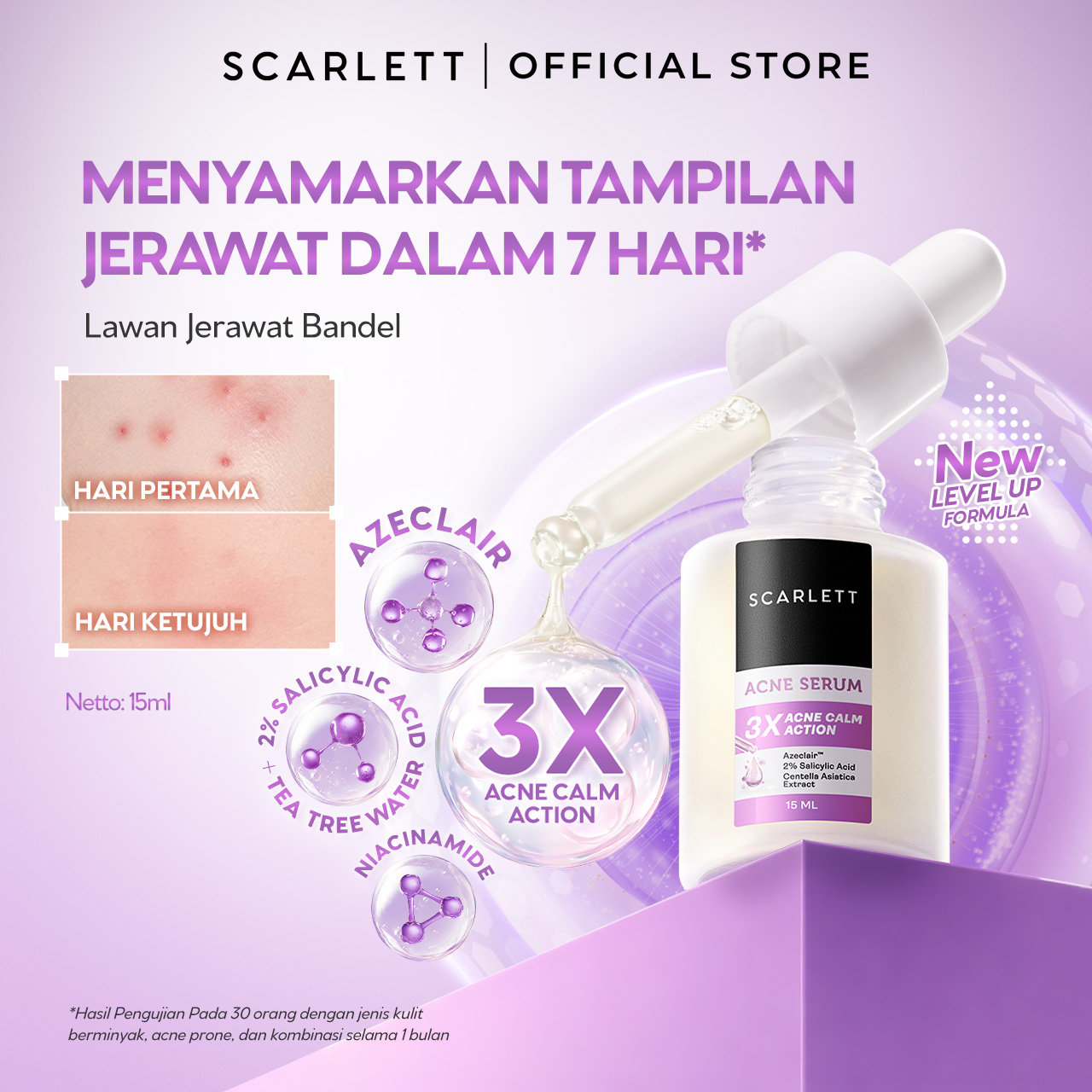 NEW FORMULA Scarlett Acne Serum Azeclair, 2% Salicylic Acid & Niacinamide - Serum Jerawat , Melawan Jerawat , Membantu Menyamarkan Tampilan Jerawat, Cocok Untuk Kulit Berjerawat